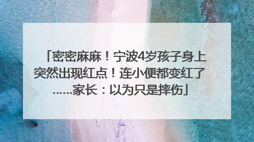 密密麻麻！宁波4岁孩子身上突然出现红点！连小便都变红了……家长：以为只是摔伤